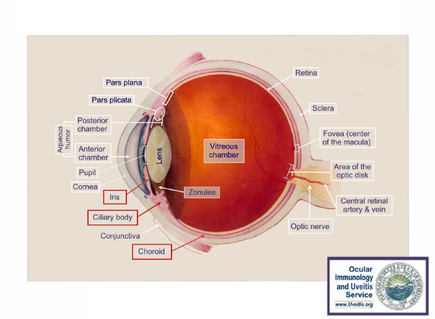 Uveitis Anatomy of the Eye 600x439