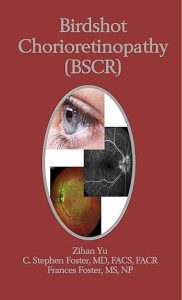 Birdshot Chorioretinopathy