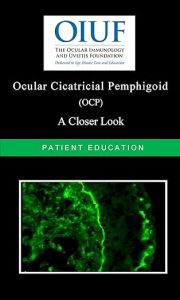 Ocular-Cicatricial-Pemphigoid